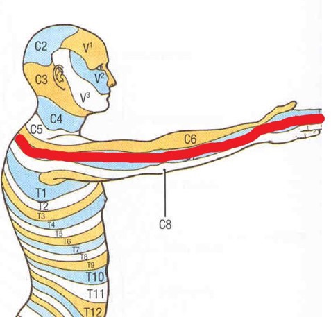 图1 神经根型颈椎病放射性疼痛到上肢前臂
