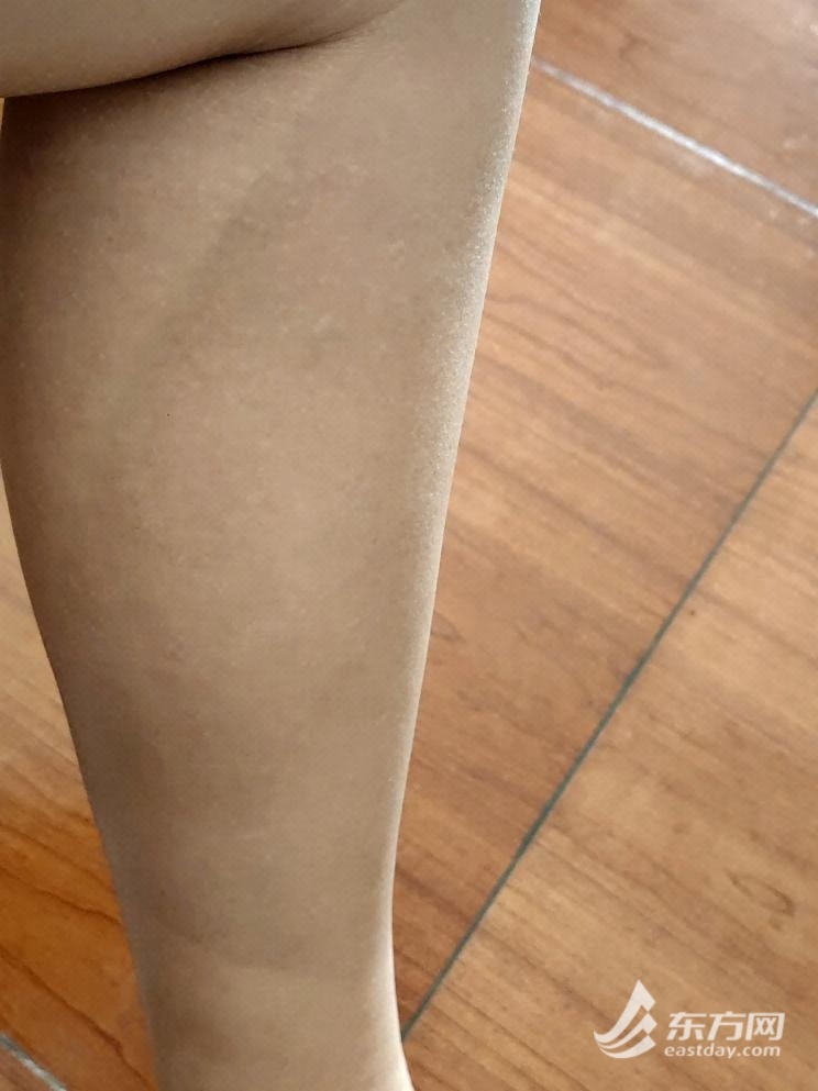 图说:水面暴晒划行半小时后,记者回到室内发现盘腿划桨时裸露的皮肤已晒伤变深。 陈丽娜 摄