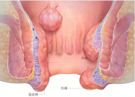 著名科学|介入手术可以用“略微侵入性”来治愈